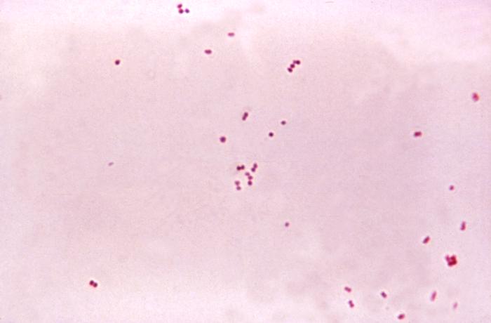 A microscope image of Neisseria meningitidis, the bacteria that causes meningococcal disease and can live harmlessly in the throat